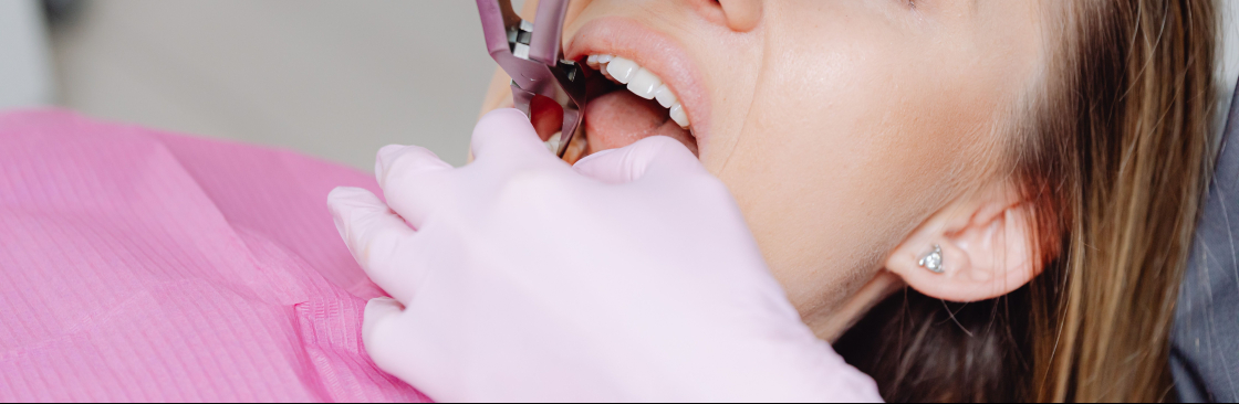 Fixed Price Dental Cover Image